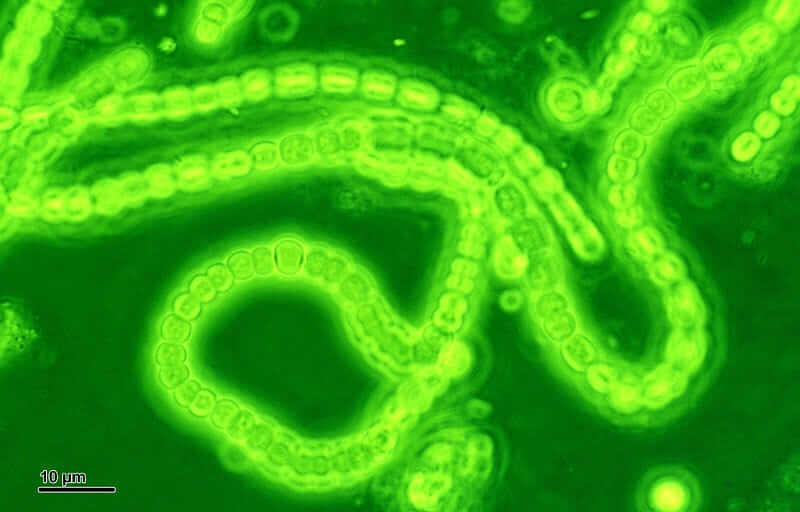 A magnified chain of neon green cyanobacteria.