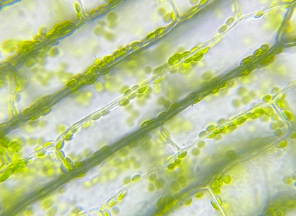 A set of plant cells magnified and stained so that the chloroplasts inside are visible.